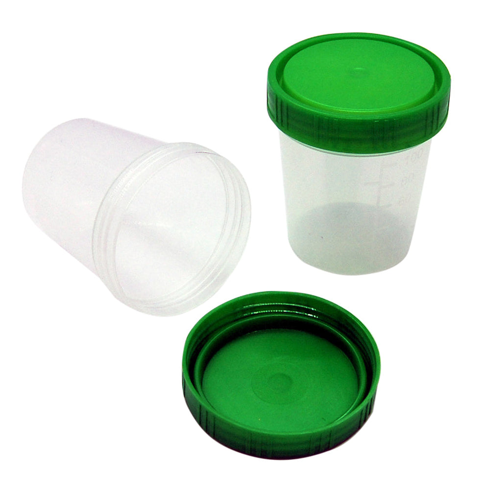 Urine Collection Sample Cups | with Lids – Access Diagnostics